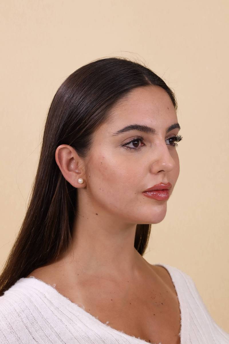 FACE FILLER after